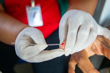 Prefeitura alinha ações sobre HIV/Aids com MS e AHF Brasil