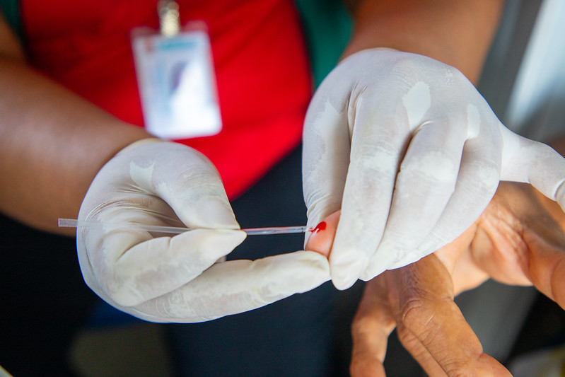 Prefeitura alinha ações sobre HIV/Aids com MS e AHF Brasil