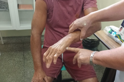 Em seis meses, Dermato Saúde realizou mais de 13 mil exames dermatológicos no interior do Amazonas