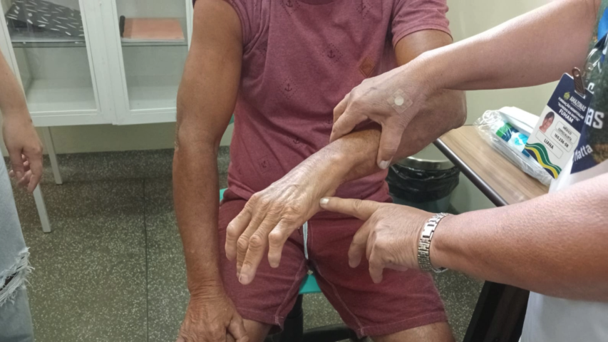 Em seis meses, Dermato Saúde realizou mais de 13 mil exames dermatológicos no interior do Amazonas