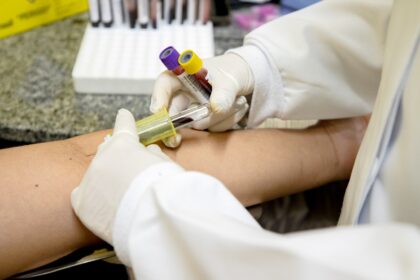 Prefeitura inicia campanha de mobilização contra a tuberculose