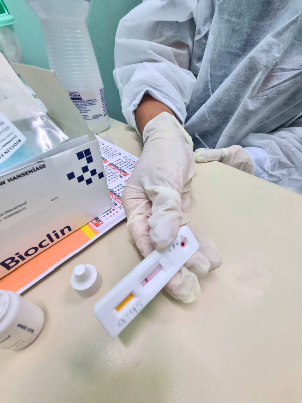 Fundação Alfredo da Matta iniciou a testagem rápida de Hanseníase
